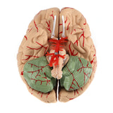 Load image into Gallery viewer, BEAMNOVA Human Brain Model for Teaching Neuroscience with Vessels Life Size Anatomy Model for Learning Science Classroom Study Display Medical Model